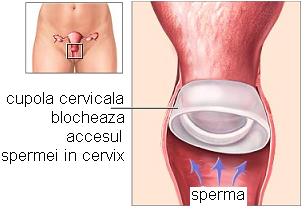 cupola cervicala